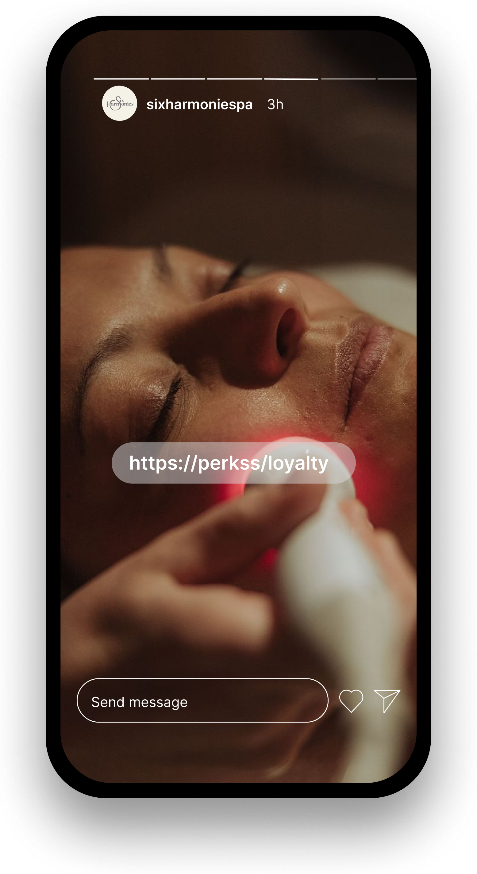 Imagen del carrusel 4